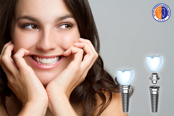 Tại sao nên chọn dịch vụ Implant tại Nha khoa thẩm mỹ Hà Nội?